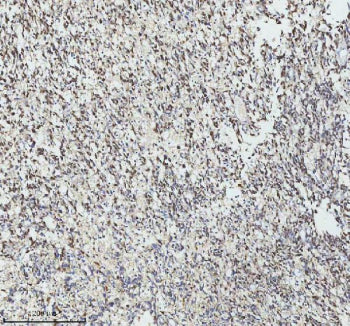 IHC analysis of GINS4 using anti-GINS4 antibody. GINS4 was detected in a paraffin-embedded section o