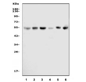 Western blot testing of human 1) HeLa, 2) K562, 3) Jurkat, 4) HL60, 5) Caco-2 and 6) HEK293 cell lys