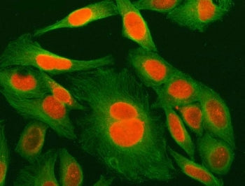 Immunofluorescent staining of FFPE human HeLa cells with MED29 antibody (red) and Beta Tubulin mAb (
