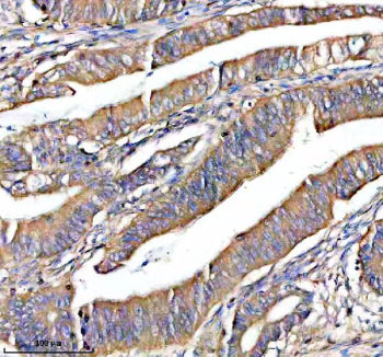 Immunohistochemical staining of NOXO1 using anti-NOXO1 antibody. NOXO1 was detected in a paraffin-em