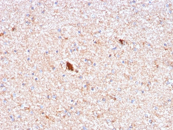 IHC staining of FFPE human brain with Serum Amyloid P antibody (clone APCS/3240). HIER: boil tissue 