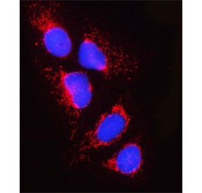 Immunofluorescent staining of FFPE human U-2 OS cells with PPM1J antibody (red) and DAPI nuclear sta