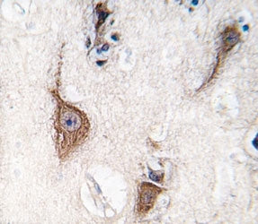 PGP9.5 Antibody (UCHL1)