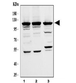 Western blot testing of human 1) A375, 2) K562 and 3) MCF7 cell lysate with EIF3B antibody. Expected
