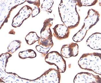 hCG alpha Antibody / Luteinizing Hormone alpha