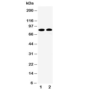 Western blot testing of Calpain 1 antibody and Lane 1: HT1080; 2: COLO320 cell lysate. Predicted mol