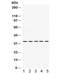 Western blot testing of 1) rat kidney, 2) mouse ovary, 3) human HeLa, 4) human MCF7 and 5) human SMM