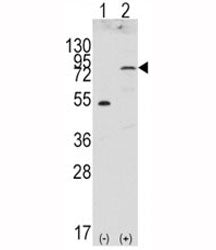 Western blot analysis of FGFR4 antibody and 293 cell lysate (2 ug/lane) either nontransfected (Lane 