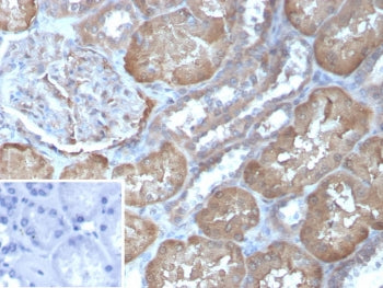 FABP1 Antibody / Fatty Acid Binding Protein 1