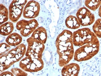 IHC staining of FFPE human kidney tissue with FABP1 antibody (clone FABP1/4990). HIER: boil tissue s