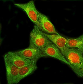 Immunofluorescent staining of FFPE human U-2 OS cells with SIX4 antibody (red) and Beta Tubulin mAb 