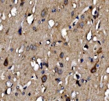 IHC staining of FFPE rat brain tissue with NMDAR2A antibody. HIER: boil tissue sections in pH8 EDTA 
