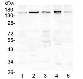 Western blot testing of human 1) HeLa, 2) placenta, 3) COLO320, 4) 22RV1 and 5) A549 lysate with EEA