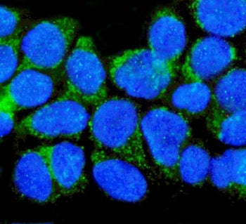 Immunofluorescent staining of FFPE human A431 cells with NGF Receptor antibody (green) and DAPI nucl