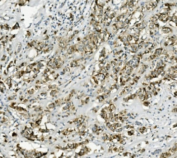 PEPCK2 Antibody / PCK2