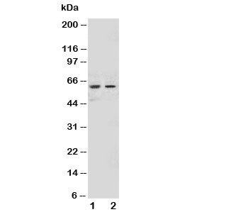 Western blot testing of NOX1 antibody and Lane 1: human HeLa; 2: human MCF-7 cell lysate.