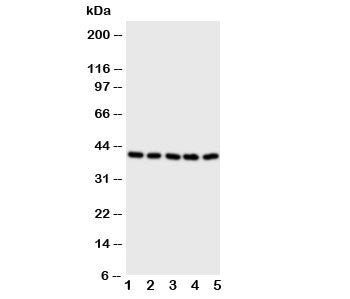 Western blot testing of BCAT2 antibody and Lane 1: A431; 2: SW620; 3: SMMC-7721; 4: Jurkat; 5: CEM c