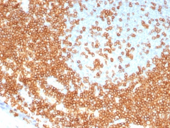 IHC staining of FFPE human tonsil tissue with recombinant CD3 epsilon antibody (clone C3e/8115R). HI