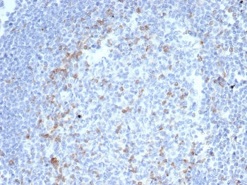 IHC staining of FFPE human tonsil tissue with Cytotoxic T-lymphocyte protein 4 antibody (clone CTLA4