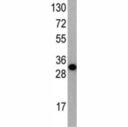 ATG7 Antibody