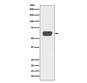 Western blot testing of human plasma lysate with tPA antibody. Expected molecular weight: 64-70 kDa.
