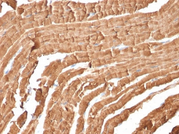 IHC staining of FFPE mouse heart with Myoglobin antibody (MB/2105). HIER: boil tissue sections in pH