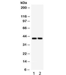SFRP4 Antibody