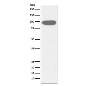 Western blot testing of human HeLa cell lysate with HSP90B1 antibody. Predicted molecular weight ~94