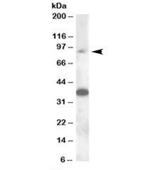 MARCH10 Antibody