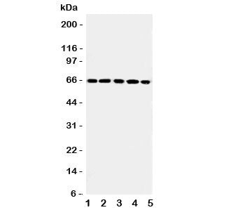 Western blot testing of RGS14 antibody and Lane 1: rat thymus; 2: (r) spleen; 3: human Raji; 4: (h) 