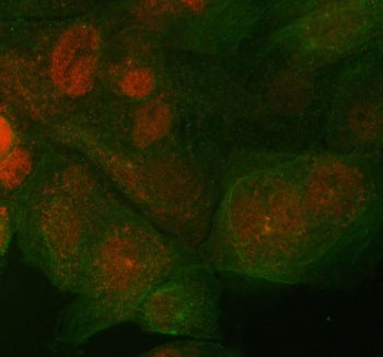 ST7 Antibody / Suppressor of Tumorigenicity 7