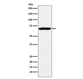 Western blot testing of human HeLa cell lysate with IGF2BP3 antibody. Predicted molecular weight ~64