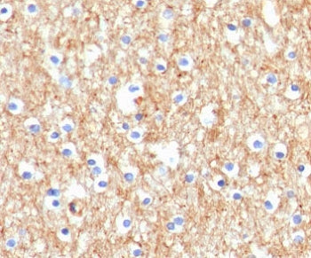 IHC staining of FFPE human brain with Drebrin 1 antibody (clone DRBP1-1). HIER: boil tissue sections