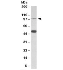 Western blot testing of human cerebellum lysate with PTCHD1 antibody at 0.5ug/ml. The expected ~100k
