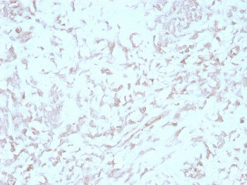 Kindlin-1 Antibody / KIND1