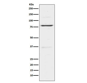 Western blot testing of human HeLa cell lysatse with INSRR antibody. Expected molecular weight: ~80 