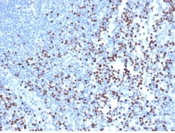 IHC staining of FFPE human lymph node with recombinant LEF1 antibody (clone rLEF1/6906) at 2ug/ml in