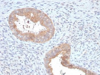 ATG5 Antibody