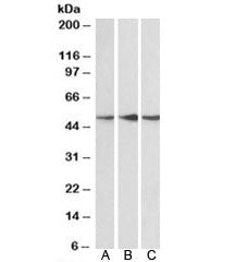 Western blot testing of human cerebellum [A], mouse [B] and rat [C] brain lysate with PPP2R5E antibo