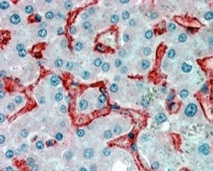 AOC3 Antibody / VAP-1