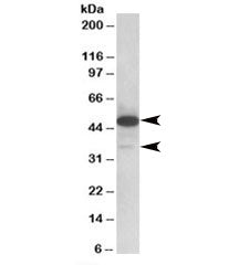 TXNDC5 Antibody