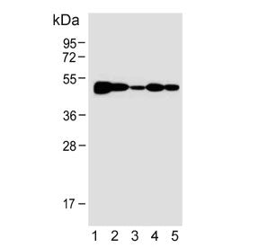 Western blot testing of human 1) HL60, 2) CCRF-CEM, 3) SH-SY5Y, 4) MOLT4 and 5) mouse Neuro-2a cell 