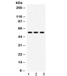 PIAS4 Antibody / PIASg
