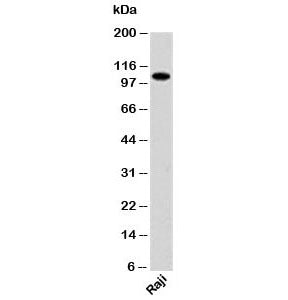 Western blot testing of human samples with PACS-1 antibody at 1ug/ml.