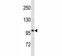 Anti-Androgen Receptor antibody western blot analysis in NCI-H292 lysate. Predicted molecular weight