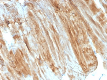 IHC staining of FFPE skeletal muscle with Dystrophin antibody (clone DMD/3243). HIER: boil tissue se
