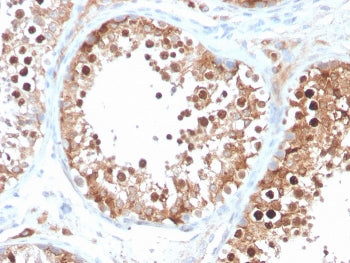 INHA Antibody / Inhibin alpha