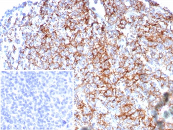IHC staining of FFPE human tonsil tissue with CD35 antibody (clone rCR1/8596). Inset: PBS used in pl
