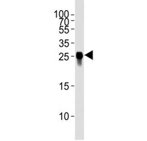 GFP Antibody (YFP)