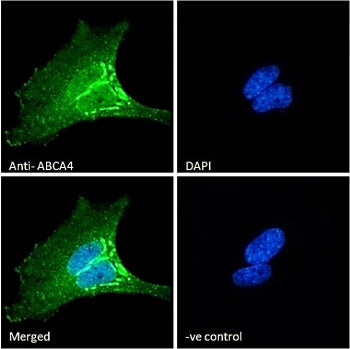 Immunofluorescent staining of fixed and permeabilized human HeLa cells with ABCA4 antibody (green) a
